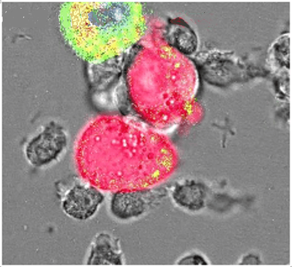 Neutrofiele granulocyten (kleurloos)scheuren stukjes van de membraan van de door antistoffen gebonden kankercellen (roze).