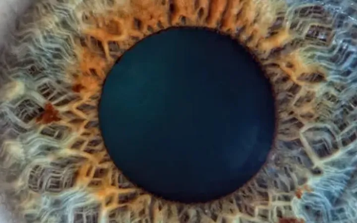 oog