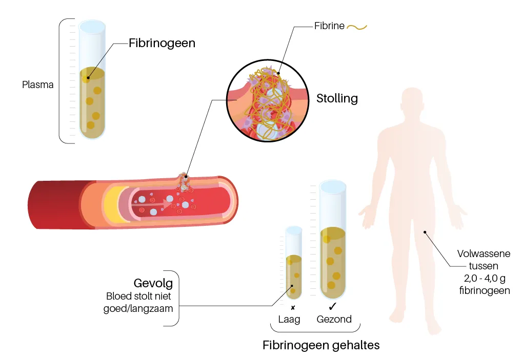 Fibrinogeen normale waardes