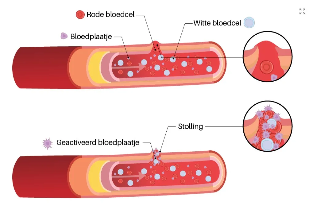 Bloedplaatjes