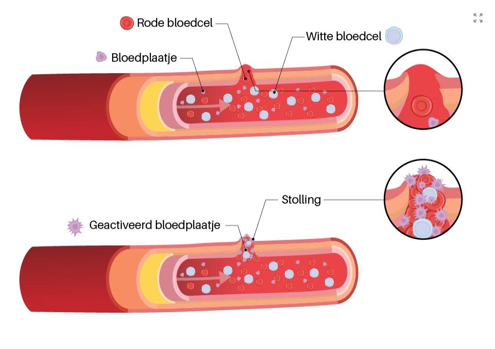 Bloedplaatjes