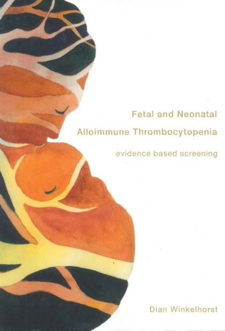 Thesis Dian Winkelhorst