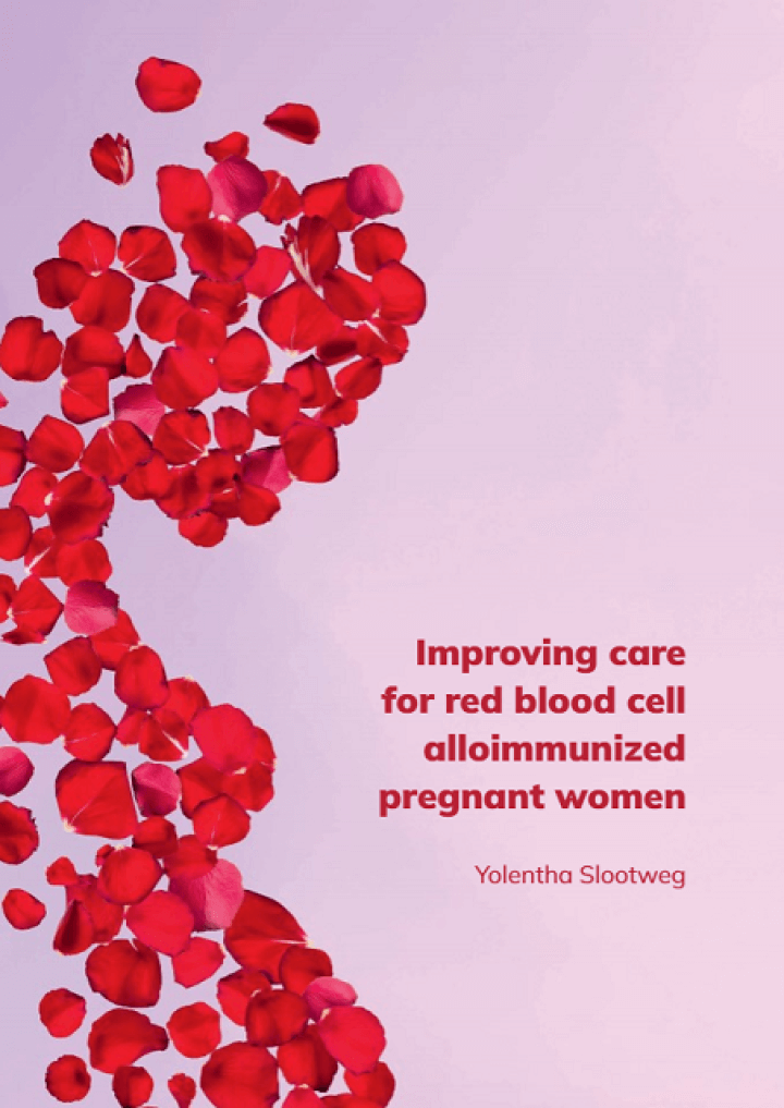 Thesis Yolentha Slootweg